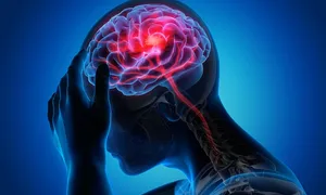 7 dấu hiệu cảnh báo nguy cơ đột quỵ 7 dấu hiệu cảnh báo nguy cơ đột quỵ