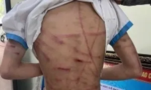 Bi kịch của những đứa trẻ bị bạo hành